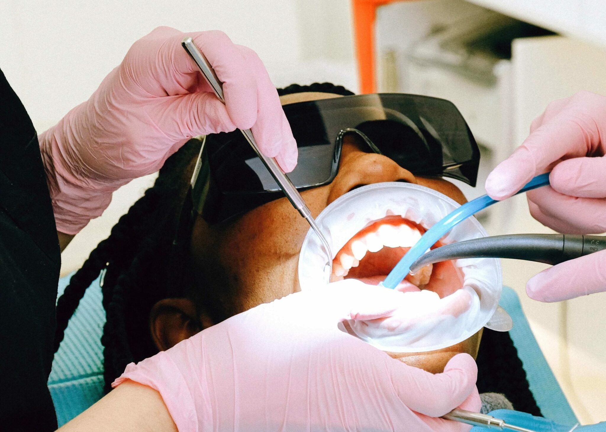 How to Treat Gingivitis