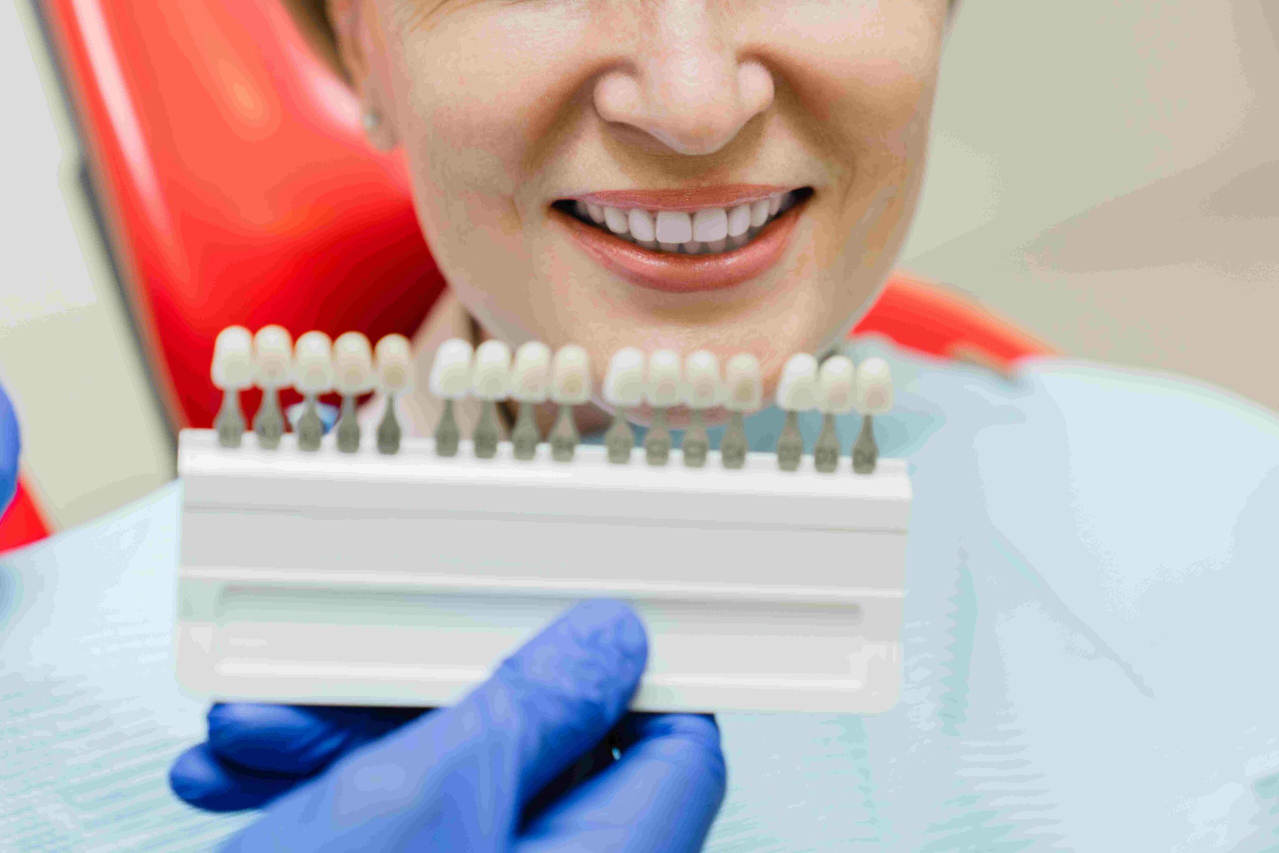 A Comprehensive Guide to All-on-4 Dental Implants: Transform Your Smile Today