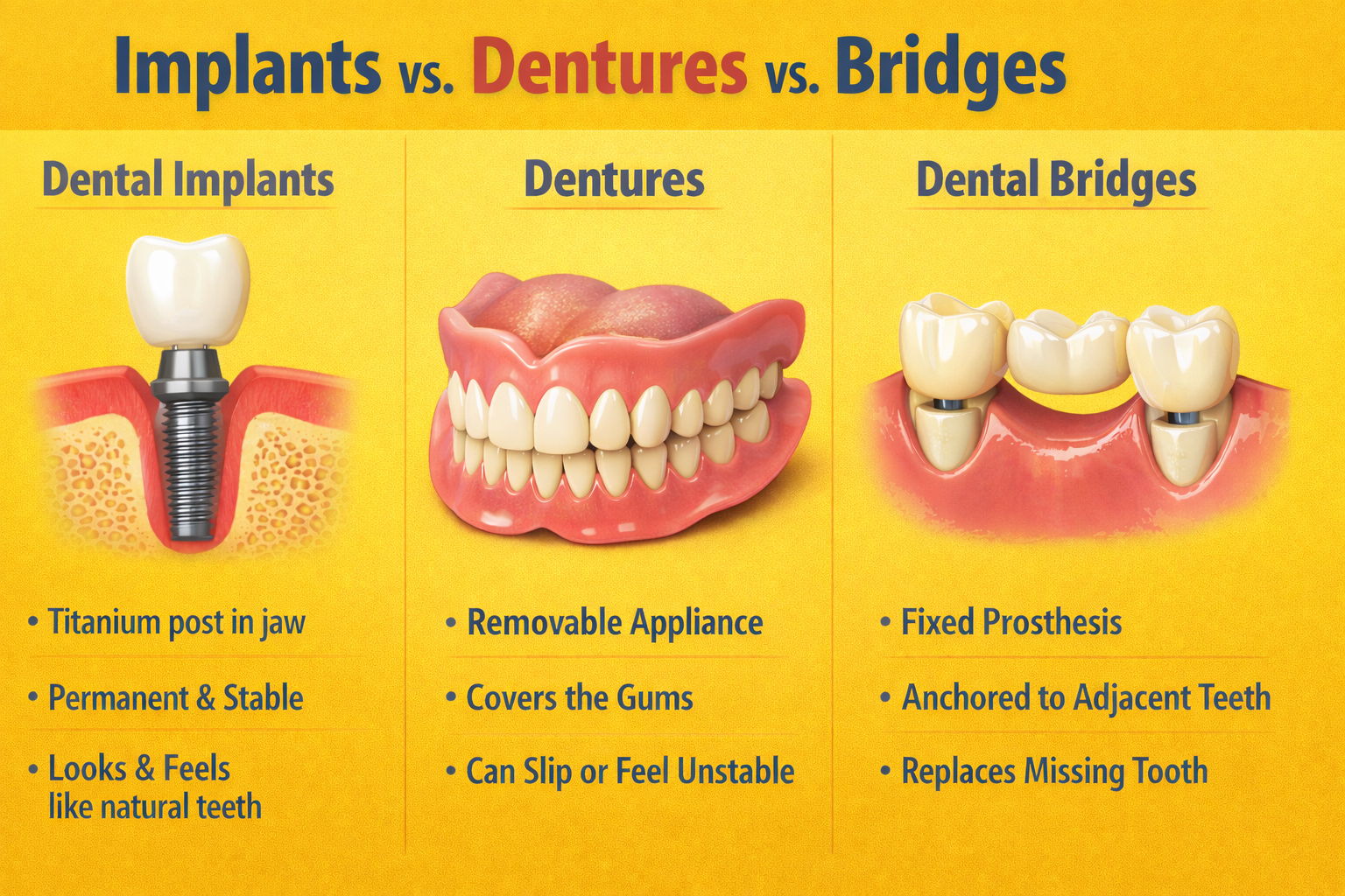 Comparing dental implants dentures and bridges